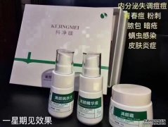 科净媄产品去痘产品好用吗_科净媄